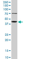 ABHD5 Antibody - ABHD5 monoclonal antibody, clone 1F3. Western blot of ABHD5 expression in human liver.