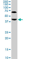 ABHD5 Antibody - ABHD5 monoclonal antibody, clone 1F3. Western blot of ABHD5 expression in Jurkat.