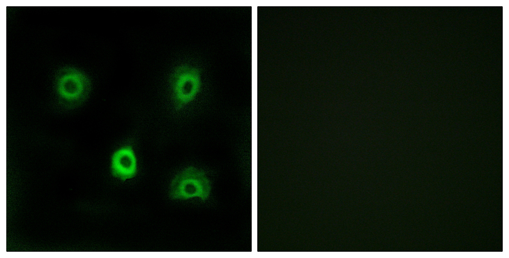 ABHD6 Antibody - Immunofluorescence analysis of A549 cells, using ABHD6 Antibody. The picture on the right is blocked with the synthesized peptide.