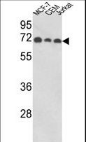ABI1 / SSH3BP1 Antibody - Western blot of ABI1 Antibody in MCF-7, CEM, Jurkat cell line lysates (35 ug/lane). ABI1 (arrow) was detected using the purified antibody.