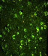 ABI1 / SSH3BP1 Antibody - Immunofluorescence of ABI1 Antibody with paraffin-embedded human brain tissue. 0.05 mg/ml primary antibody was followed by FITC-conjugated goat anti-rabbit lgG (whole molecule). FITC emits green fluorescence.
