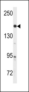 ABL Antibody - Western blot of anti-ABL Antibody (Y251) in A2058 cell line lysates (35 ug/lane). ABL(arrow) was detected using the purified antibody.