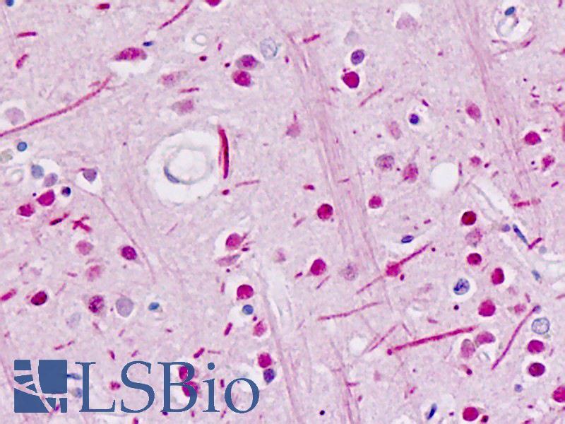 ABL Antibody - Human Brain: Formalin-Fixed, Paraffin-Embedded (FFPE)