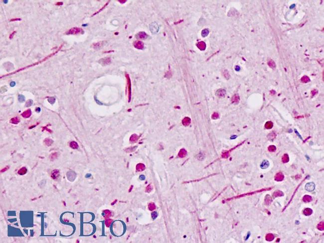 ABL Antibody - Human Brain: Formalin-Fixed, Paraffin-Embedded (FFPE)
