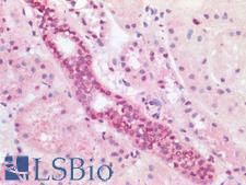 ABL1 / c-ABL Antibody - Human Kidney: Formalin-Fixed, Paraffin-Embedded (FFPE)