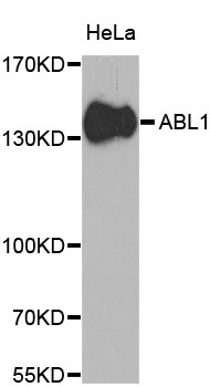 ABL1 / c-ABL Antibody - Western blot analysis of extracts of HeLa cells, using ABL1 antibody at 1:1000 dilution. The secondary antibody used was an HRP Goat Anti-Rabbit IgG (H+L) at 1:10000 dilution. Lysates were loaded 25ug per lane and 3% nonfat dry milk in TBST was used for blocking. An ECL Kit was used for detection and the exposure time was 90s.