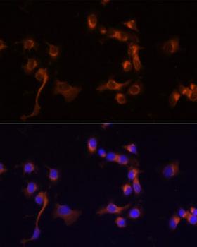 ABL1 / c-ABL Antibody - Immunofluorescence analysis of A431 cells using ABL1 antibodyat dilution of 1:100 (40x lens). Blue: DAPI for nuclear staining.