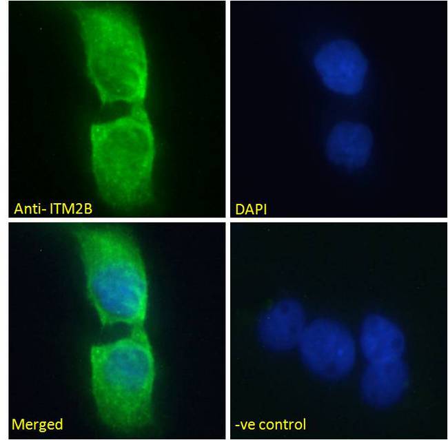 ABRI / ITM2B Antibody - ABRI / ITM2B antibody immunofluorescence analysis of paraformaldehyde fixed A431 cells, permeabilized with 0.15% Triton. Primary incubation 1hr (10ug/ml) followed by Alexa Fluor 488 secondary antibody (2ug/ml), showing vesicle staining. The nuclear stain is DAPI (blue).