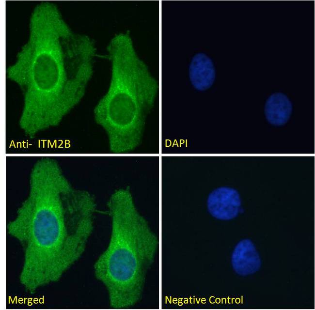 ABRI / ITM2B Antibody - ABRI / ITM2B antibody immunofluorescence analysis of paraformaldehyde fixed HeLa cells, permeabilized with 0.15% Triton. Primary incubation 1hr (10ug/ml) followed by Alexa Fluor 488 secondary antibody (2ug/ml), showing vesicle staining. The nuclear stain is DAPI (blue).