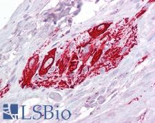 ABRI / ITM2B Antibody - Anti-ITM2B antibody IHC of human small intestine, myenteric plexus. Immunohistochemistry of formalin-fixed, paraffin-embedded tissue after heat-induced antigen retrieval. Antibody concentration 2.5 ug/ml.