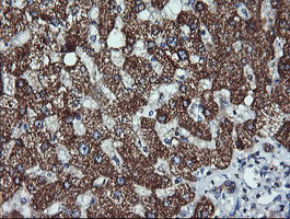 ACAA2 Antibody - IHC of paraffin-embedded Human liver tissue using anti-ACAA2 mouse monoclonal antibody, at a dilution of 1:150.