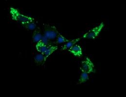 ACAA2 Antibody - Anti-ACAA2 mouse monoclonal antibody immunofluorescent staining of COS7 cells transiently transfected by pCMV6-ENTRY ACAA2.