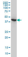 ACAA2 Antibody - Antibody LS-B6205, Western blot of ACAA2 expression in HeLa.