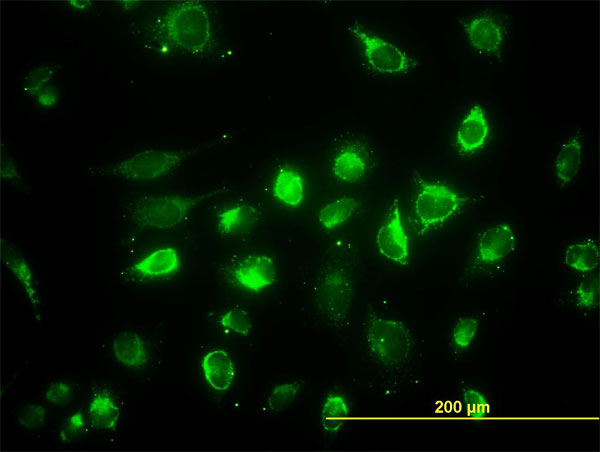 ACAA2 Antibody - Immunofluorescence of monoclonal antibody to ACAA2 on HeLa cell. [antibody concentration 40 ug/ml]