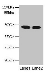 ACADL Antibody - Western blot All lanes: ACADL antibody at 8µg/ml Lane 1: Mouse kidney tissue Lane 2: Mouse heart tissue Secondary Goat polyclonal to rabbit IgG at 1/10000 dilution Predicted band size: 48 kDa Observed band size: 48 kDa