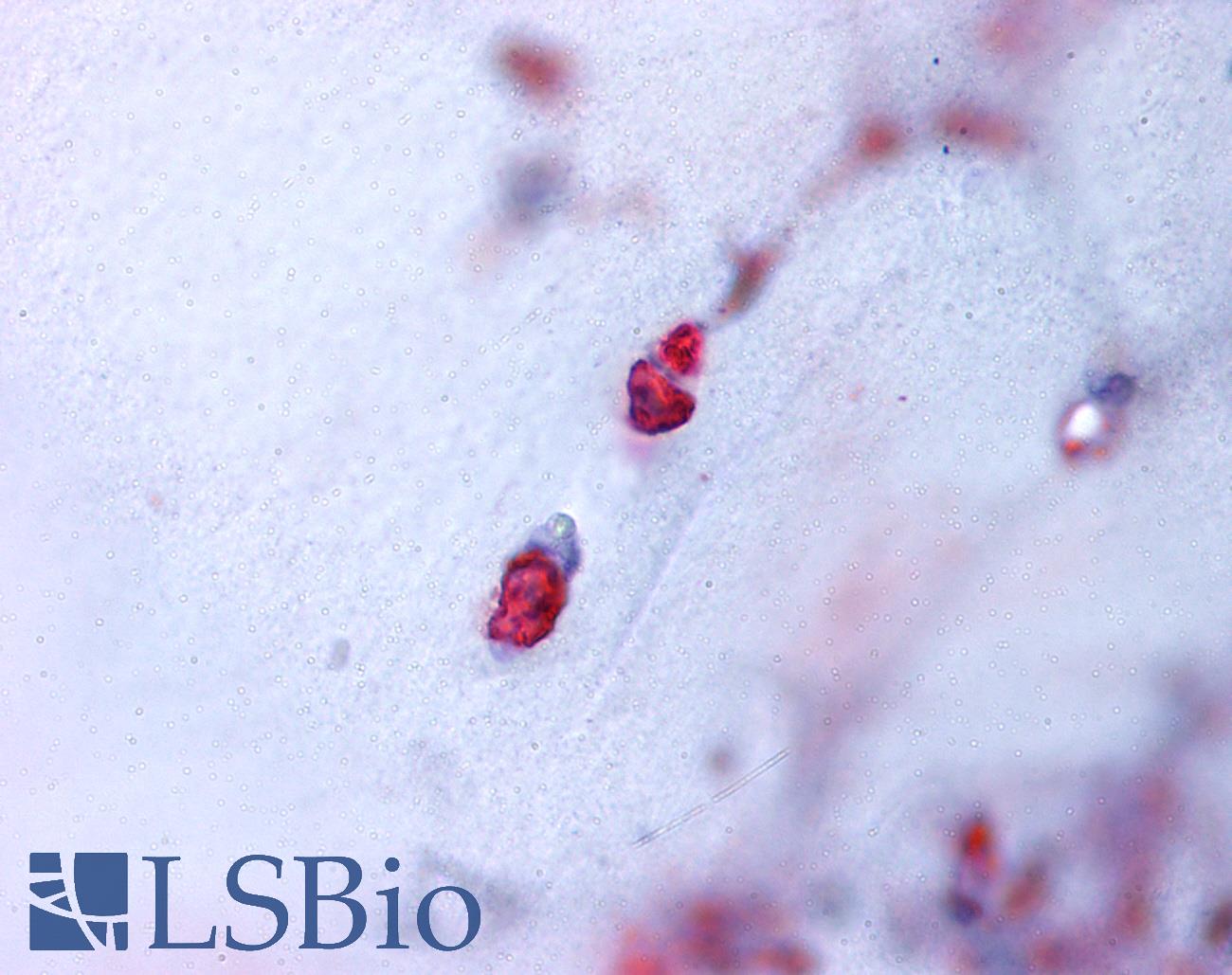 ACAN / Aggrecan Antibody - Anti-ACAN / Aggrecan antibody IHC of human bone, cartilage. Immunohistochemistry of formalin-fixed, paraffin-embedded tissue after heat-induced antigen retrieval.