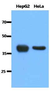 ACAT1 Antibody - Western Blot: The cell lysates (40 ug) were resolved by SDS-PAGE, transferred to PVDF membrane and probed with anti-human ACAT1 antibody (1:1000). Proteins were visualized using a goat anti-mouse secondary antibody conjugated to HRP and an ECL detection system.
