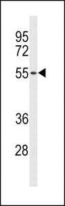 ACCN1 / ASIC2 Antibody - Western blot of ACCN1 Antibody in NCI-H460 cell line lysates (35 ug/lane). ACCN1 (arrow) was detected using the purified antibody.