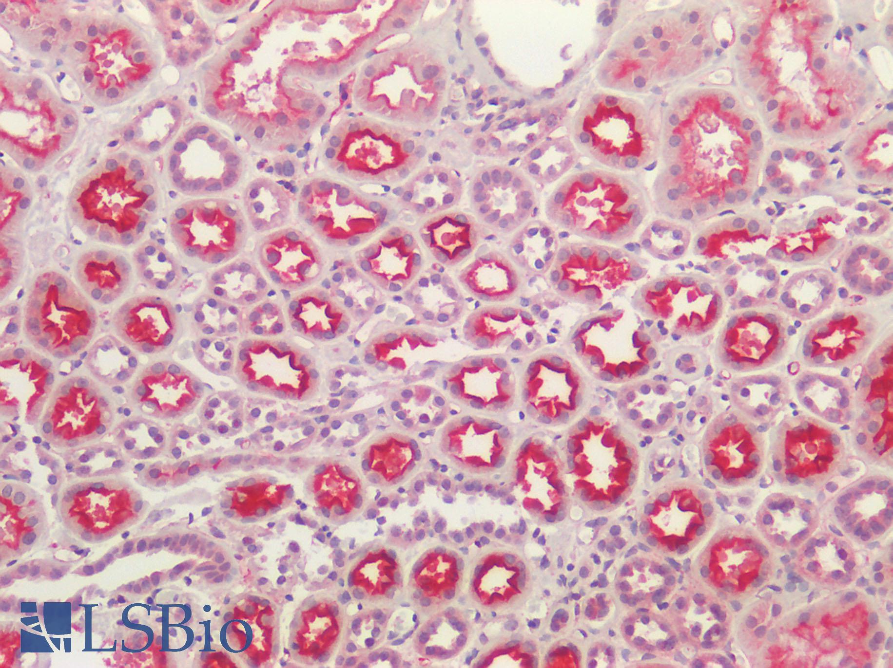 ACE / CD143 Antibody - Human Kidney: Formalin-Fixed, Paraffin-Embedded (FFPE)