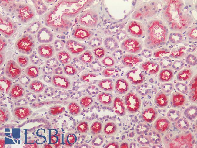 ACE / CD143 Antibody - Human Kidney: Formalin-Fixed, Paraffin-Embedded (FFPE)