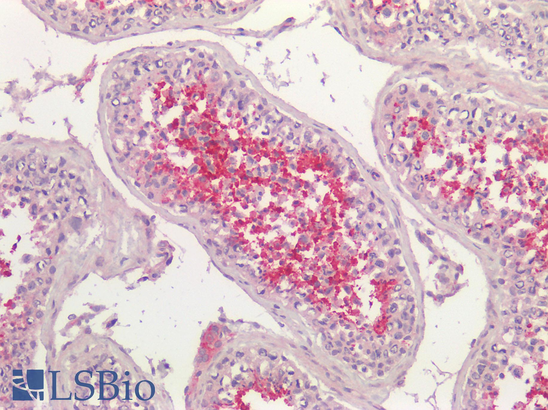 ACE / CD143 Antibody - Human Testis: Formalin-Fixed, Paraffin-Embedded (FFPE)