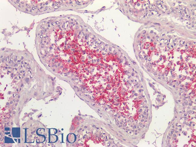 ACE / CD143 Antibody - Human Testis: Formalin-Fixed, Paraffin-Embedded (FFPE)