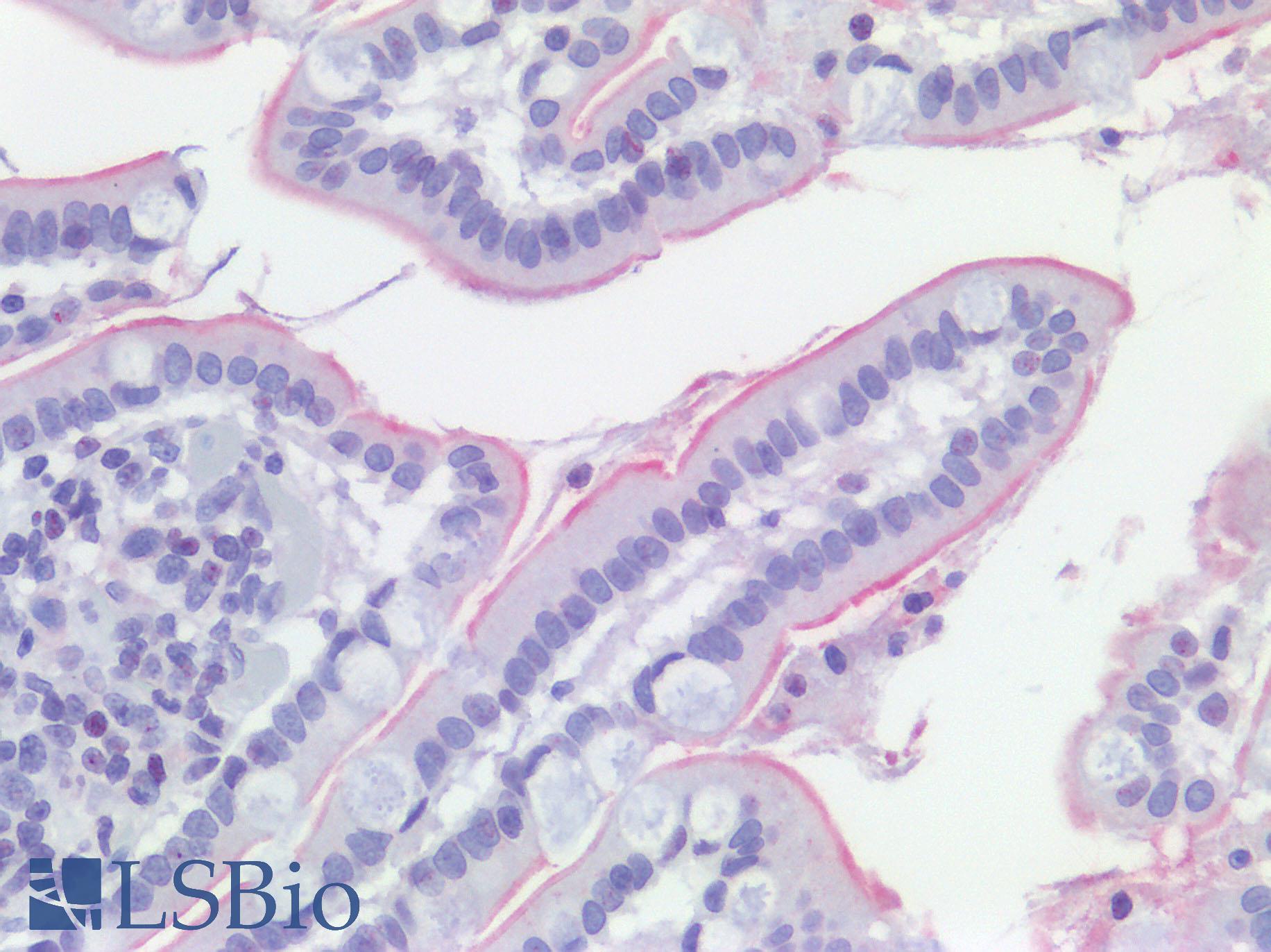 ACE2 / ACE-2 Antibody - Anti-ACE-2 antibody IHC of Human Small Intestine. Positive staining of Enterocyte brush border, all other cell types negative. Immunohistochemistry of formalin-fixed, paraffin-embedded tissue after heat-induced antigen retrieval.