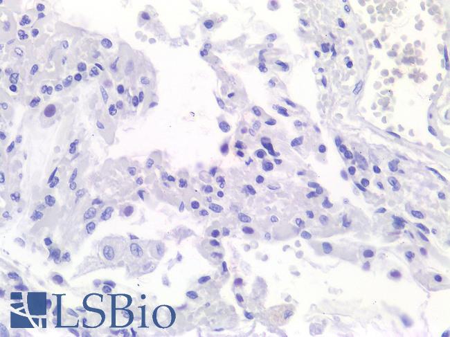 ACE2 / ACE-2 Antibody - Anti-ACE-2 antibody IHC of Human Lung. No positive staining. Immunohistochemistry of formalin-fixed, paraffin-embedded tissue after heat-induced antigen retrieval.