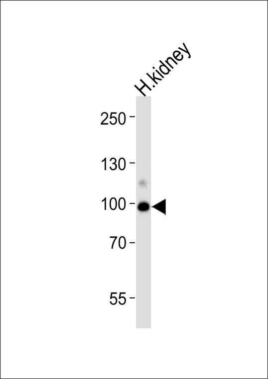 ACE2 / ACE-2 Antibody - Western blot analysis of lysate from human kidney tissue lysate, using ACE2 (SARS-Receptor) Antibody. LS-B6672 was diluted at 1:1000 at each lane. A goat anti-rabbit IgG H&L(HRP) at 1:5000 dilution was used as the secondary antibody.