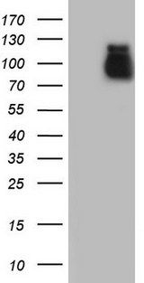 ACE2 / ACE-2 Antibody - HEK293T cells were transfected with the pCMV6-ENTRY control (Left lane) or pCMV6-ENTRY ACE2 (Right lane) cDNA for 48 hrs and lysed. Equivalent amounts of cell lysates (5 ug per lane) were separated by SDS-PAGE and immunoblotted with anti-ACE2.