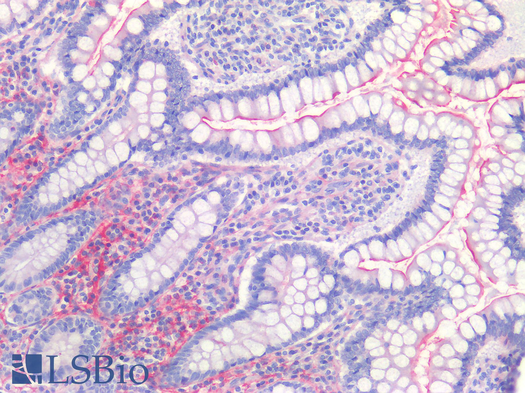 ACE2 / ACE-2 Antibody - Human Small Intestine: Formalin-Fixed, Paraffin-Embedded (FFPE)