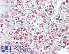 Acetyl-CoA Carboxylase / ACC Antibody - Anti-Acetyl-CoA Carboxylase / ACC antibody IHC staining of human adrenal. Immunohistochemistry of formalin-fixed, paraffin-embedded tissue after heat-induced antigen retrieval. Antibody concentration 5 ug/ml.