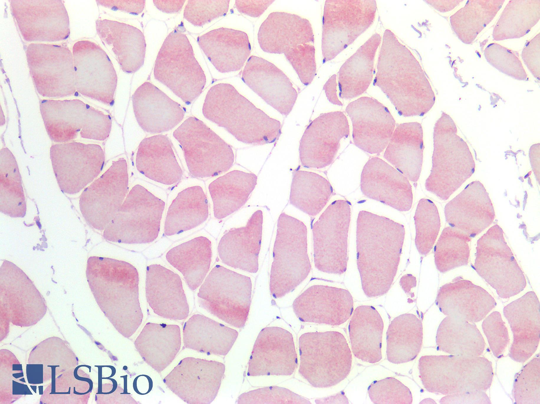 ACHE / Acetylcholinesterase Antibody - Human Skeletal Muscle: Formalin-Fixed, Paraffin-Embedded (FFPE)