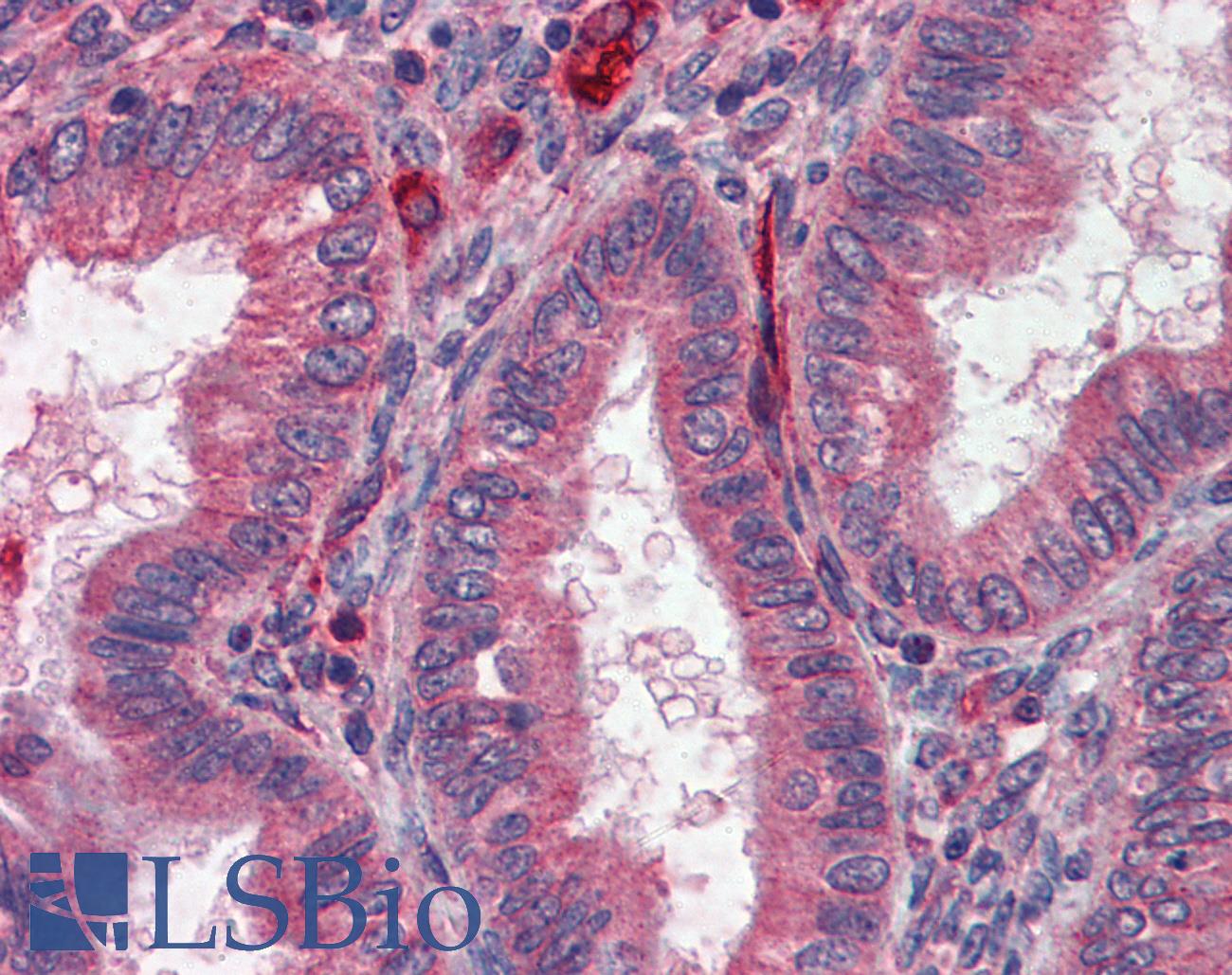 ACHE / Acetylcholinesterase Antibody - Anti-Acetylcholinesterase antibody IHC of human uterus. Immunohistochemistry of formalin-fixed, paraffin-embedded tissue after heat-induced antigen retrieval. Antibody concentration 5 ug/ml.