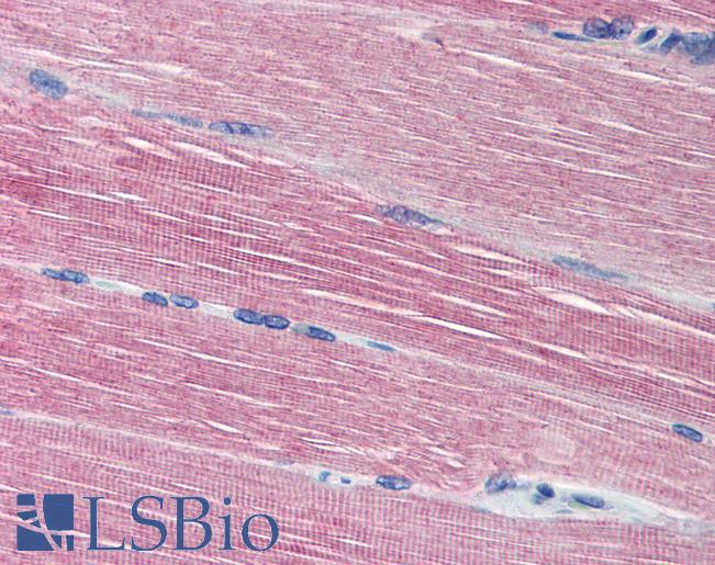 ACHE / Acetylcholinesterase Antibody - Anti-Acetylcholinesterase antibody IHC of human skeletal muscle. Immunohistochemistry of formalin-fixed, paraffin-embedded tissue after heat-induced antigen retrieval. Antibody concentration 20 ug/ml.