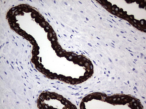 Acidic Cytokeratin Antibody - IHC of paraffin-embedded Human prostate tissue using anti-Acidic CK rat monoclonal antibody.
