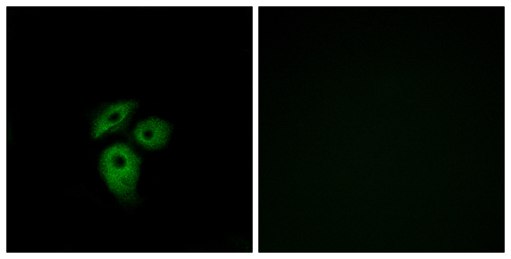 ACKR1 / DARC Antibody - Immunofluorescence analysis of A549 cells, using CD234 Antibody. The picture on the right is blocked with the synthesized peptide.
