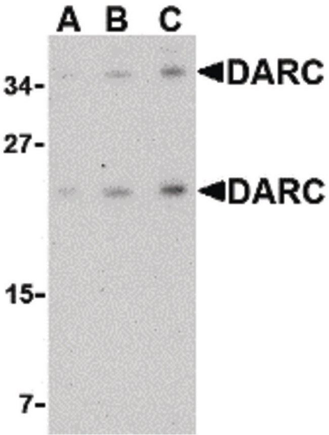 ACKR1 / DARC Antibody - Western blot of DARC in mouse brain tissue lysate with DARC antibody at (A) 0.5, (B) 1 and (C) 2 ug/ml.