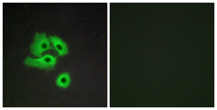 ACKR2 / CCR10 / D6 Antibody - Immunofluorescence analysis of COS7 cells, using CCBP2 Antibody. The picture on the right is blocked with the synthesized peptide.