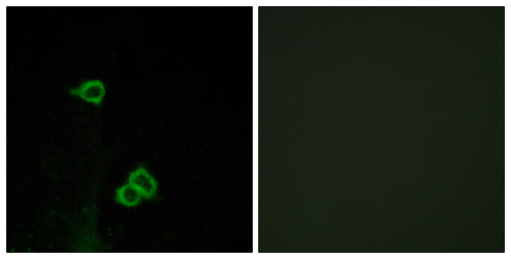 ACKR3 / CXCR7 Antibody - Immunofluorescence analysis of COS7 cells, using CXCR7 Antibody. The picture on the right is blocked with the synthesized peptide.