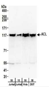 ACLY / ATP Citrate Lyase Antibody - Detection of Human ACL by Western Blot. Samples: Whole cell lysate from Jurkat (15 and 50 ug), HeLa (50 ug), and 293T (50 ug) cells. Antibodies: Affinity purified rabbit anti-ACL antibody used for WB at 0.4 ug/ml. Detection: Chemiluminescence with an exposure time of 30 seconds.