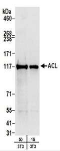 ACLY / ATP Citrate Lyase Antibody - Detection of Mouse ACL by Western Blot. Samples: Whole cell lysate (15 and 50 ug) from mouse NIH3T3 cells. Antibodies: Affinity purified rabbit anti-ACL antibody used for WB at 0.4 ug/ml. Detection: Chemiluminescence with an exposure time of 10 seconds.