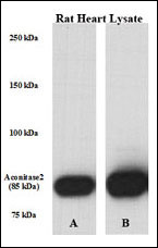 ACO2 / Aconitase 2 Antibody - Perfused isolated rat heart whole tissue lysate was lysed with either A) 50 mM Tris-HCl, 150 mM NaCl, 1 mM EDTA, 1% NP-40, 0.1% SDS, 0.5% Na-deoxycholate, 1 mM Na3VO4, 20 mM NaF, 1 mM PMSF, 5 v/v % protease inhibitor cocktail or B) T-PER Tissue Protein Extraction Reagent [# 785101; Pierce], containing 1mM Na3VO4, 20 mM NaF, 5 v/v % protease inhibitor cocktail (Sigma); PVDF membrane was incubated in primary Ab [rabbit polyclonal antibody against ACO2. Solution: 1:1000 diluted in 5% NFM TBS-T 0,05 for overnight (15 hrs) at 4 ?. Data courtesy of Boglarka Laczy M.D., Division of Cardiovascular Disease, Dept. of Medicine, University of Alabama at Birmingham.