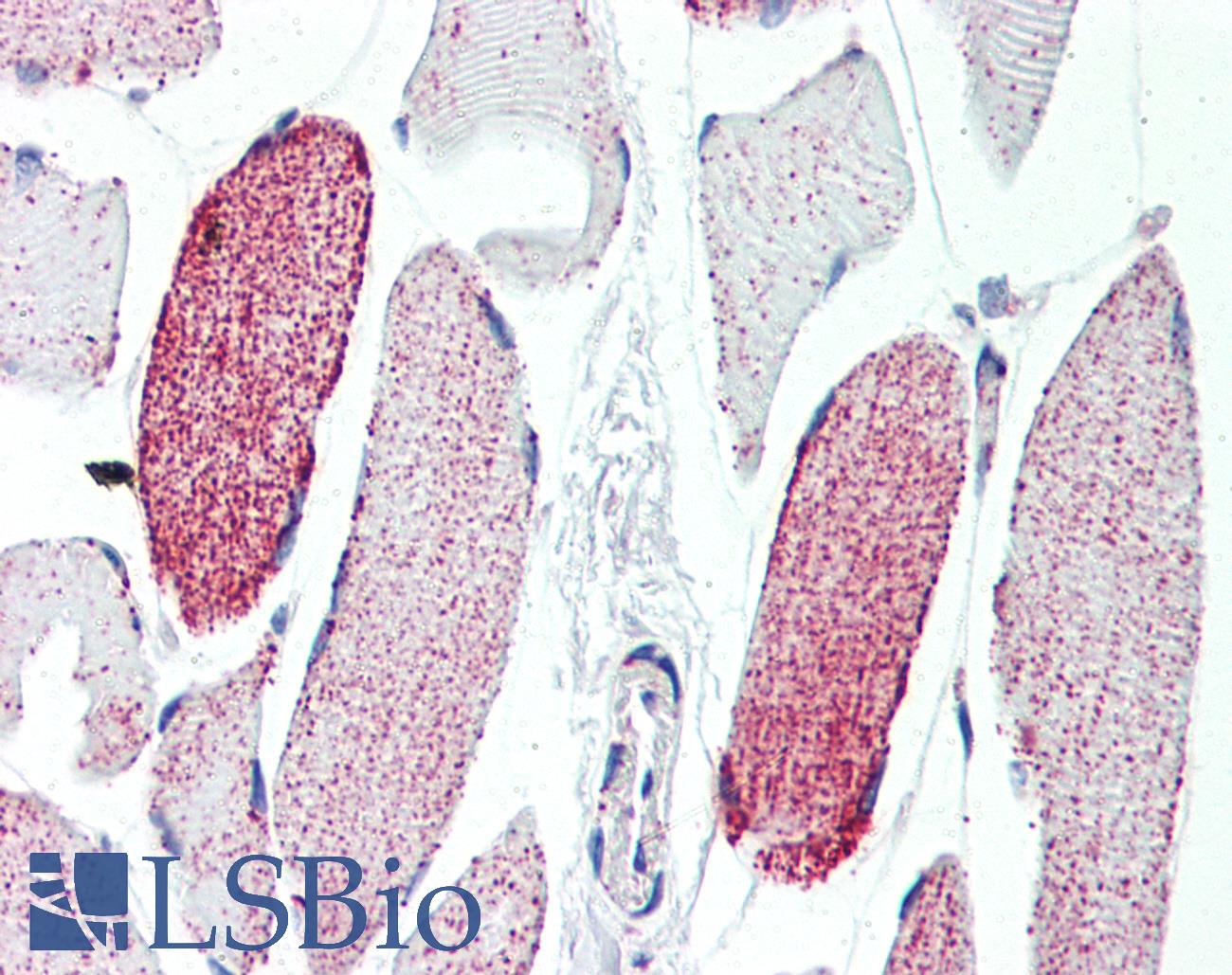 ACO2 / Aconitase 2 Antibody - Anti-ACO2 antibody IHC of human skeletal muscle. Immunohistochemistry of formalin-fixed, paraffin-embedded tissue after heat-induced antigen retrieval. Antibody concentration 10 ug/ml.