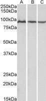 ACO2 / Aconitase 2 Antibody - Goat Anti-Aconitase 2 (aa541-555) Antibody (0.01µg/ml) staining of Mouse (A), Rat (B) and Pig (C) Skeletal Muscle lysates (35µg protein in RIPA buffer). Primary incubation was 1 hour. Detected by chemiluminescencence.