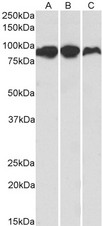 ACO2 / Aconitase 2 Antibody - Goat Anti-Aconitase 2 (aa541-555) Antibody (0.1µg/ml) staining of Human (A), Mouse (B) and Rat (C) Adipose lysates (35µg protein in RIPA buffer). Primary incubation was 1 hour. Detected by chemiluminescencence.