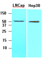 ACOT11 / THEA Antibody - Cell lysates of LNCap, Hep3B (30 ug) were resolved by SDS-PAGE, transferred to NC membrane and probed with anti-human ACOT11 (1:1000). Proteins were visualized using a goat anti-mouse secondary antibody conjugated to HRP and an ECL detection system.