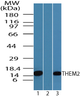 ACOT13 / THEM2 Antibody - Western blot of THEM2 in 293 cell lysate in the 1) absence and 2) presence of immunizing peptide and 3) RAW cell lysate using ACOT13 / THEM2 Antibody at 0.05 ug/ml.