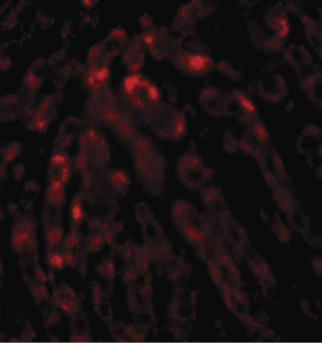 ACOT13 / THEM2 Antibody - Immunofluorescence of THEM2 in human liver tissue with THEM2 antibody at 20 ug/ml.