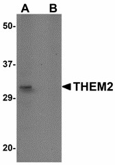 ACOT13 / THEM2 Antibody - Western blot of THEM2 in HepG2 cell lysate with THEM2 antibody at 1 ug/ml in (A) the absence and (B) the presence of blocking peptide. 